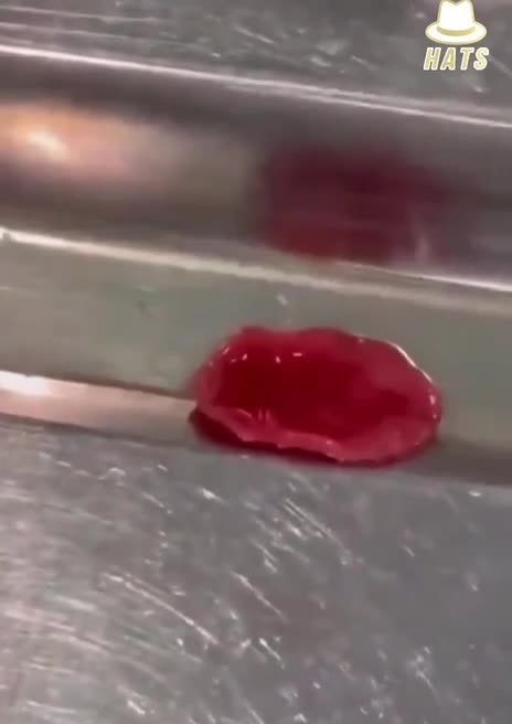 This is a liver fluke found in the stomach of someone who got you-know