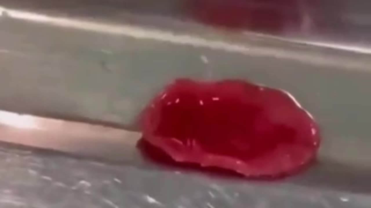 This is a liver fluke found in the stomach of someone who got you-know