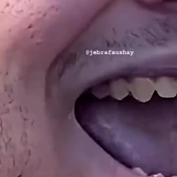 Hormone Blockers Are NOT Reversible, Actually 🏳️‍⚧️ #shorts