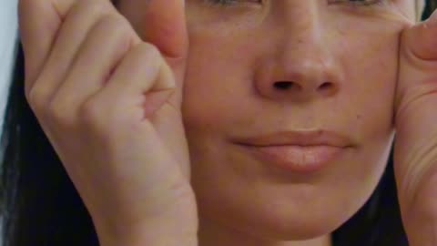 What is the recovery period after microneedling?