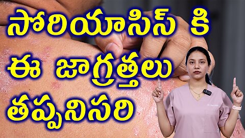 సోరియాసిస్ కి ఈ జాగ్రత్తలు తప్పనిసరి These Precautions are Essential for Psoriasis Homeopathy Cure