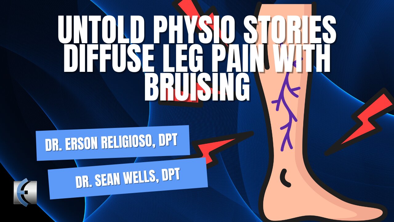 Untold Physio Stories Podcast - Diffuse Leg Pain with Bruising