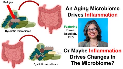 An Aging Microbiome Drives Inflammation, Or Maybe Inflammation Drives Changes To The Microbiome?