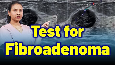 Test for Fibroadenoma.| Treatment and Cure | Homeopathy, Medicine & Surgery
