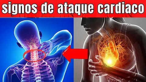 ¿Sabías que Reconocer los Signos de un Infarto Puede Salvar Tu Vida