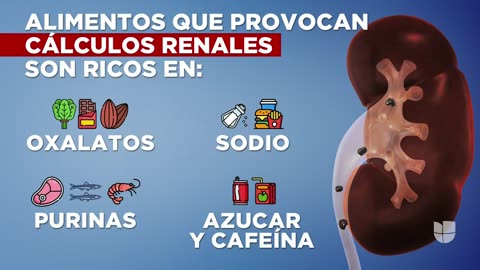 Aumentan los casos de cálculos renales en niños: te contamos qué alimentos pueden producirlos