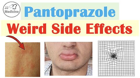 Pantoprazole Weird Side Effects (Skin, Infections, Nutrient Deficiencies) & Why They Occur