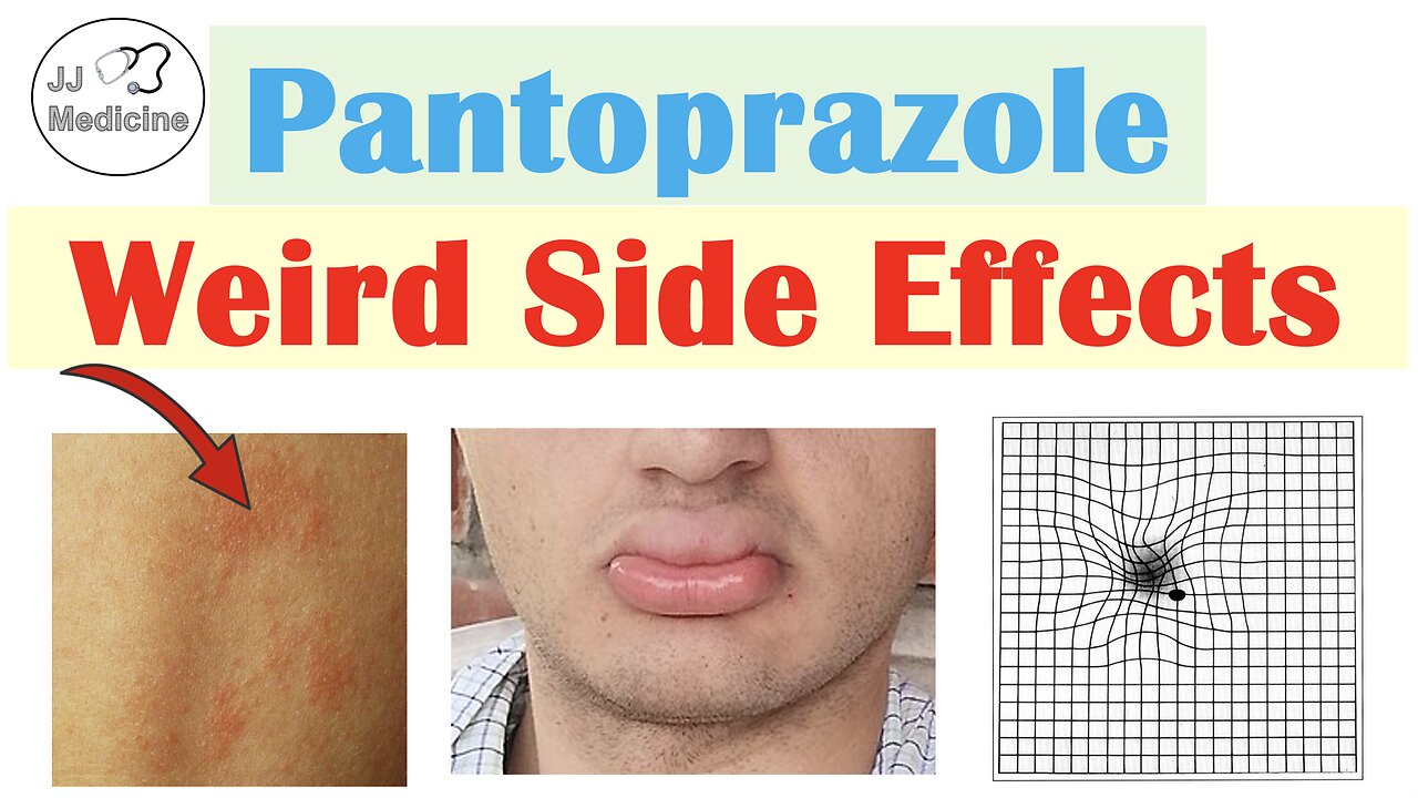 Pantoprazole Weird Side Effects (Skin, Infections, Nutrient Deficiencies) & Why They Occur