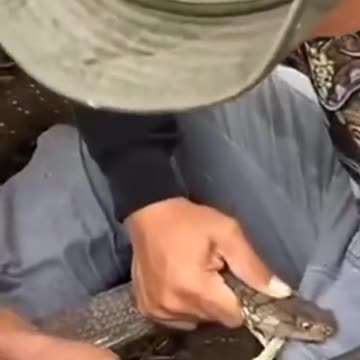 Snake Bite: Most Important Part of Body