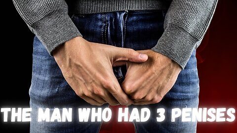 The story of the man who had 3 MALE MEMBERS