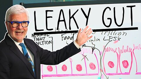 The Surprising Truth About Leaky Gut Nobody Tells You