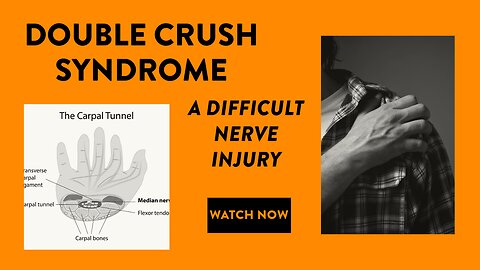 Double crush syndrome: A difficult nerve injury