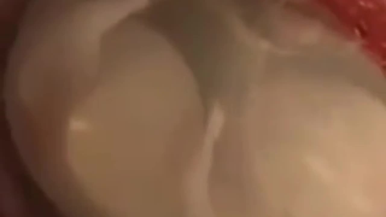 70