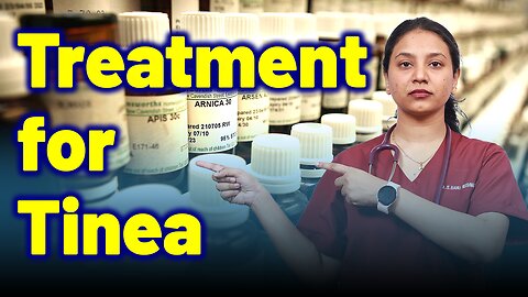 Best Treatment for Tinea | Treatment Cure Relief Medicine | Skin Hair Nail | Dr. Bharadwaz