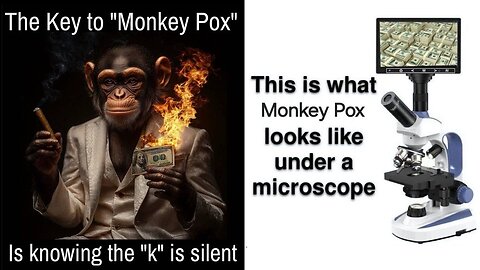 Money pox aka monkey pox