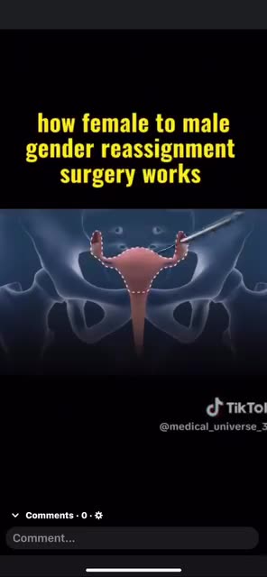 TRANS OPERATION EXPLAINED