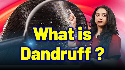 What is Dandruff, Seborrheic Dermatitis? |Treatment Cure Relief Medicine | Skin Hair Nail |