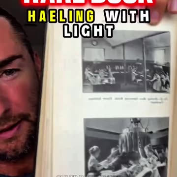 Lupus In 1902 Treatment