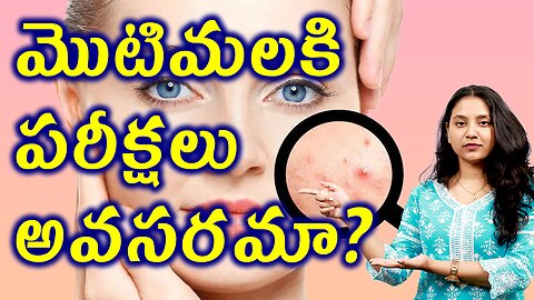 మొటిమలకి పరీక్షలు అవసరమా? Tests and Investigations for ACNE, Pimples | డా. భరద్వాజ్ | హోమియోపతి