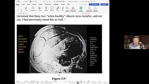 Jerome Corsi Final Analysis: The JFK Head Shots - Jim Fetzer, Dr. Montik FEB2025