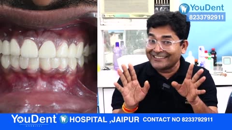 Best Smile Designing Treatment In Jaipur