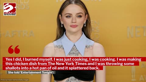 Joey King's chin is 'healing up nicely' after she suffered an accidental burn