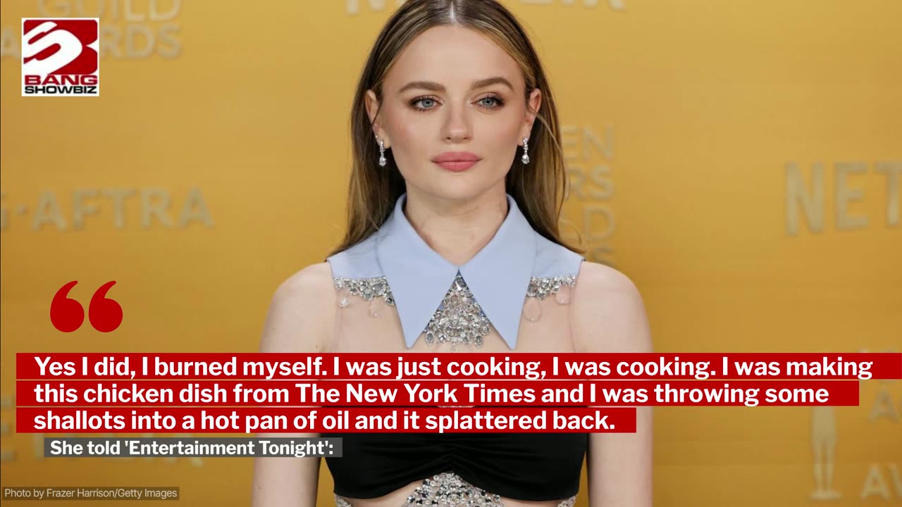 Joey King's chin is 'healing up nicely' after she suffered an accidental burn