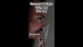 Morbidly Obese Man Weight loss journey