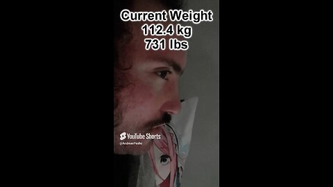 Morbidly Obese Man Weight loss journey