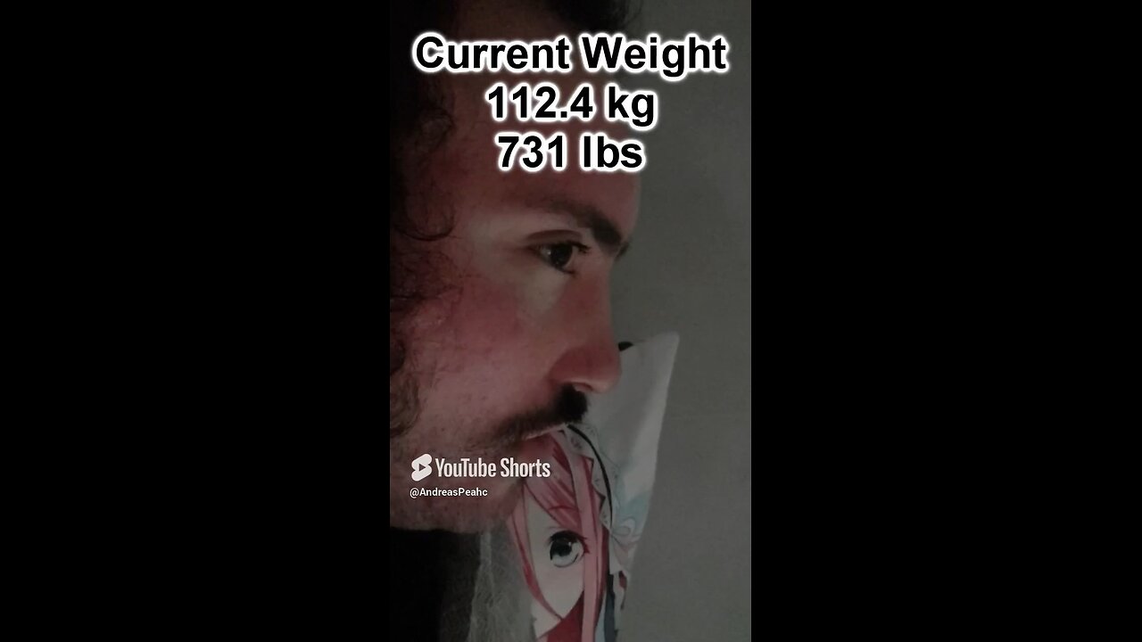 Morbidly Obese Man Weight loss journey