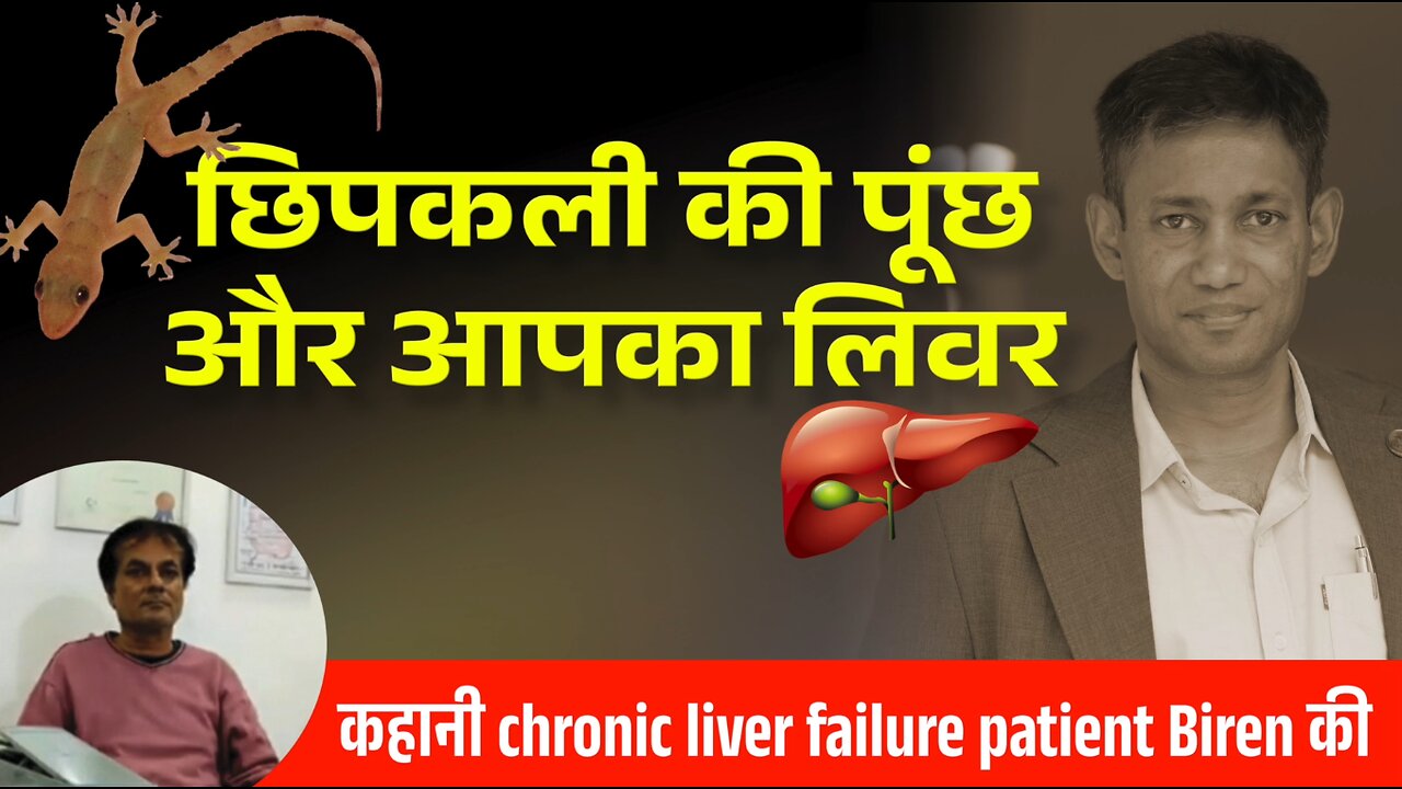 कहानी Chronic Liver Failure Patient Biren की