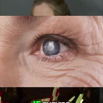 Reduce Eye pressure with Herbal Mix 🌿