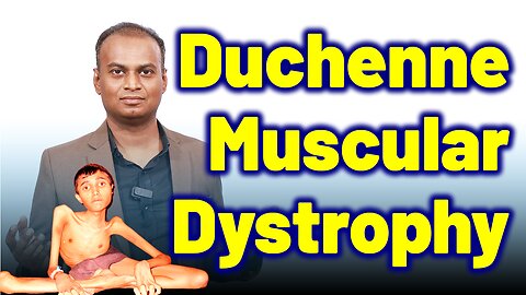 Duchenne Muscular Dystrophy. | Dr. Bharadwaz | Homeopathy, Medicine & Surgery