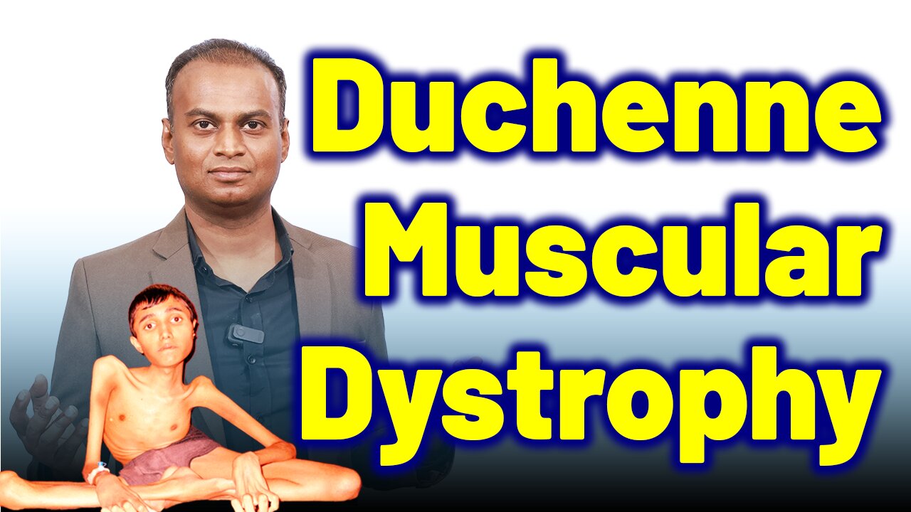 Duchenne Muscular Dystrophy. | Dr. Bharadwaz | Homeopathy, Medicine & Surgery