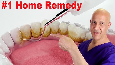 Top Home Remedy to Remove Dental Plaque and Tartar, Preventing Cavities | Dr. Mandell