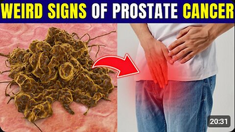 Men Over 40, Watch for These Prostate Cancer Symptoms!_ Healthy Everyday