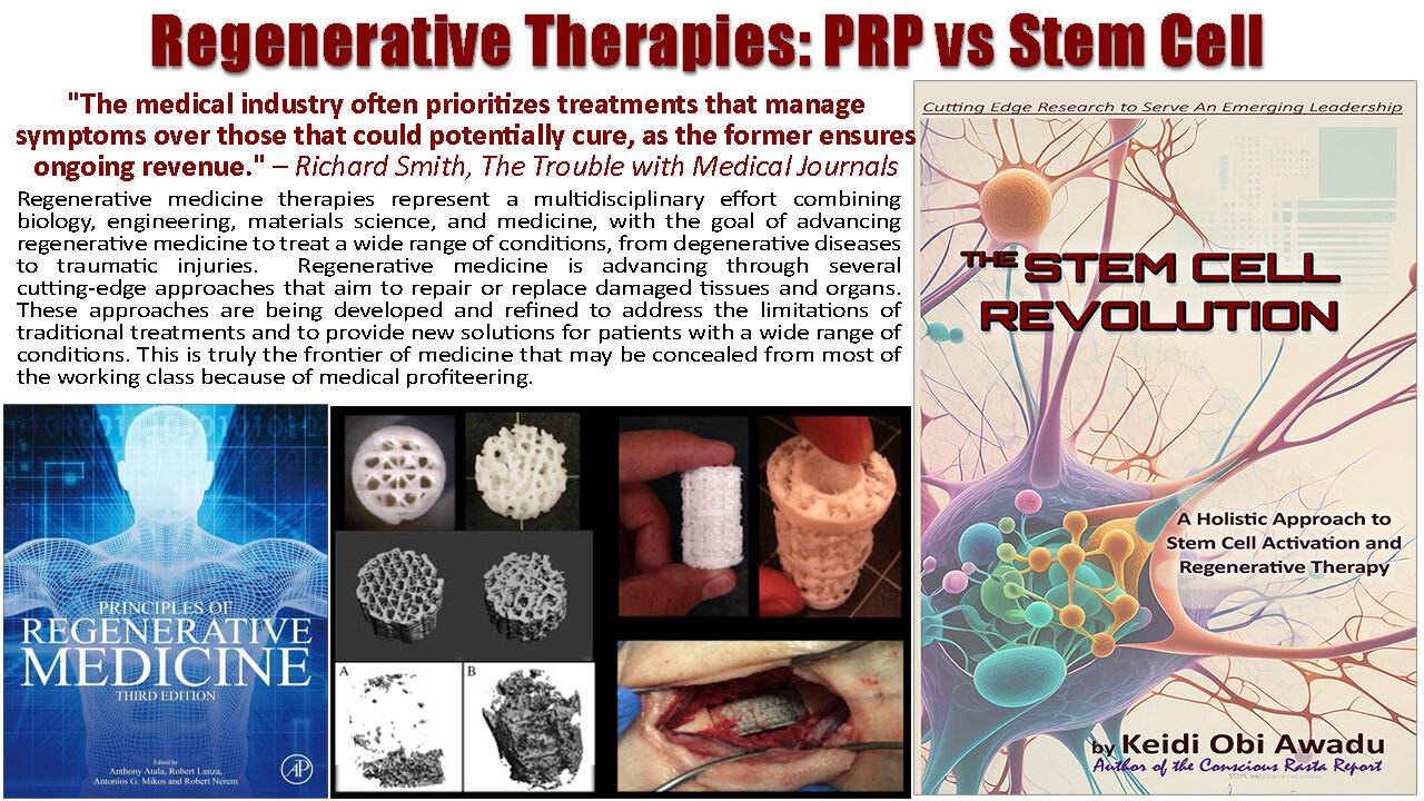 Regenerative Therapies: PRP vs Stem Cell