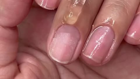 💅✂️ Safely Remove Your Nails At Home: Step-By-Step Guide!🚫✨