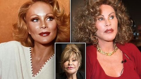 "Catwoman Jocelyn Wildenstein Passes Away"