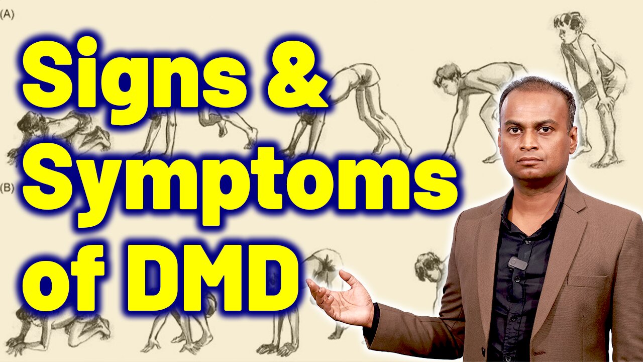 Signs and Symptoms of Duchenne Muscular Dystrophy or DMD | Dr. Bharadwaz | Homeopathy, Medicine