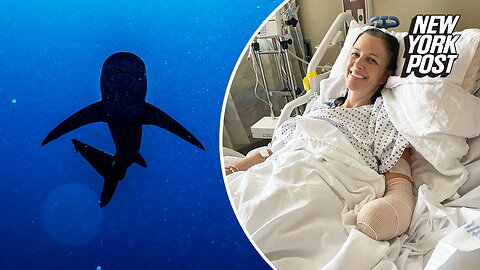 Shark attack victim learns insurance won't cover $73K prosthetic hand