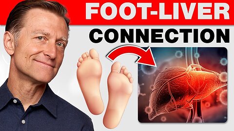 Dr Berg : How Your Feet Are Warning You About Your Liver Problems