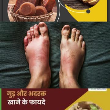 गुड़ और अदरक खाने के फायदे