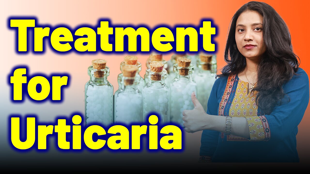 Treatment for Urticaria, Nettle rash, Hives, Wheals.| SkinAllergy FoodAllergy| Treatment Cure Relief