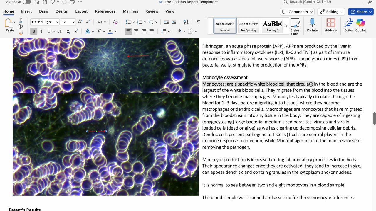 Live Blood Analysis Post Consultation Report