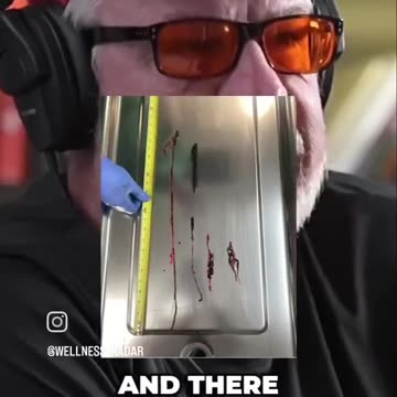 The Rise Of Turbo Cancer...The SV40