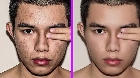 Quick and Easy Face Cleaning in Photoshop: Effortlessly Remove Pimples, Blemishes, and Acne"