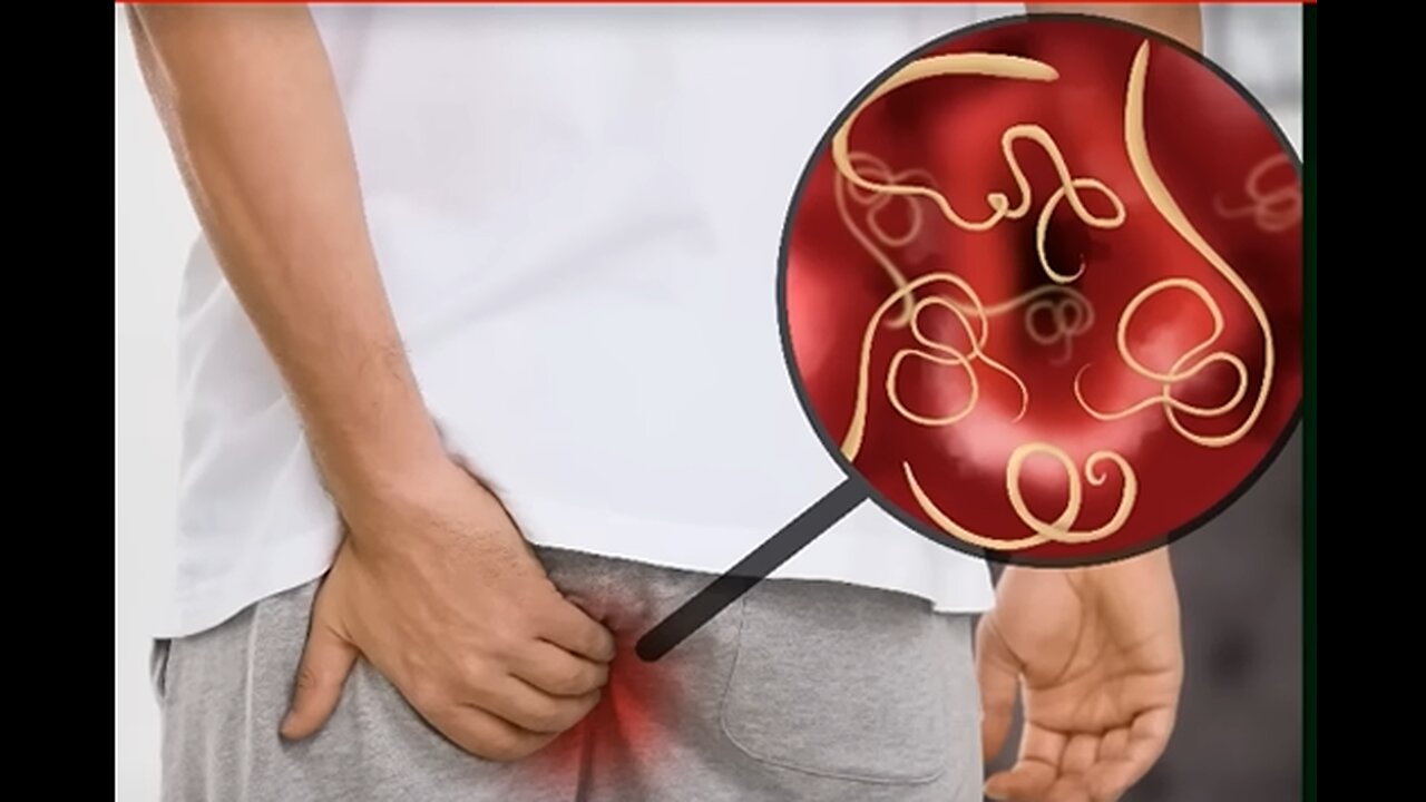 EXPEL ALL WORMS AND PARASITES FROM YOUR BODY WITH ONLY 2 SPOONS