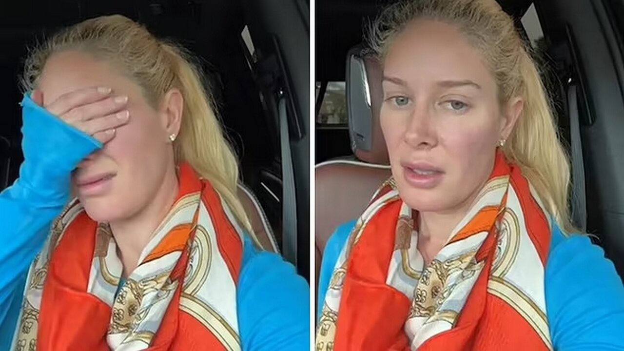 Heidi Montag’s Tragic Wildfire Loss