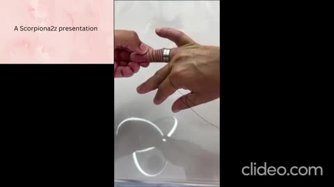 How to remove a ring from the finger that is stuck